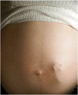 A influência da MGF na fertilidade